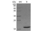 Recombinant Mouse Cystatin 8/CST8 Protein (His Tag) 
