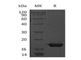 Recombinant Mouse Cystatin 7/CST7 Protein (His Tag)