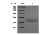 Recombinant Mouse CTLA4 Protein (Flag Tag)