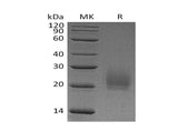 Recombinant Mouse CTLA4 Protein (His Tag)(Active)