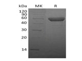 Recombinant Mouse CTLA4 Protein (Fc Tag)(Active)