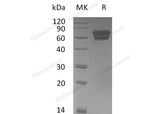 Recombinant Mouse EDAR/DL Protein (Fc Tag)