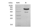 Recombinant Mouse Ephrin-A1/EFNA1 Protein (Fc & His Tag)(Active)