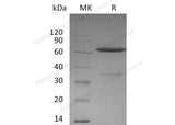 Recombinant Mouse Ephrin-A3/EFNA3 Protein (Fc Tag) 