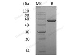 Recombinant Mouse Ephrin-A4/EFNA4 Protein (Fc Tag)