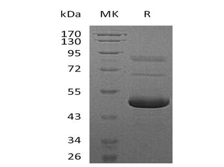 Recombinant Mouse Ephrin-A5/EFNA5 Protein (His Tag)(Active)