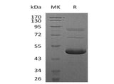Recombinant Mouse Ephrin-A5/EFNA5 Protein (His Tag)(Active)