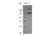 Recombinant Mouse Ephrin-B1/EFNB1 Protein (Fc & His Tag)