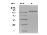 Recombinant Mouse Ephrin-B2/EFNB2 Protein (Fc & His Tag)