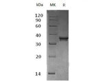 Recombinant Mouse Exostosin-Like 2/EXTL2 Protein (His Tag) 