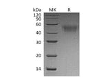 Recombinant Mouse CD64/FCGR1 Protein (His Tag)
