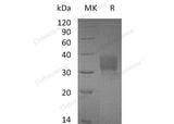 Recombinant Mouse CD32b/FCGR2B Protein (His Tag)
