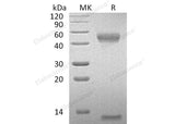 Recombinant Mouse FcRn & B2M Heterodimer Protein (His Tag)
