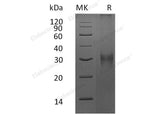 Recombinant Mouse Fibrillin-1/FBN1 Protein (His Tag)
