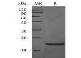 Recombinant Mouse FGF-2/FGFb Protein (aa 1-154)(Active)