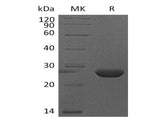 Recombinant Mouse FGF-9/FGF9 Protein (His Tag)(Active)