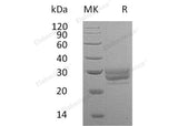 Recombinant Mouse FLT3LG/Flt3 Ligand Protein (His Tag)
