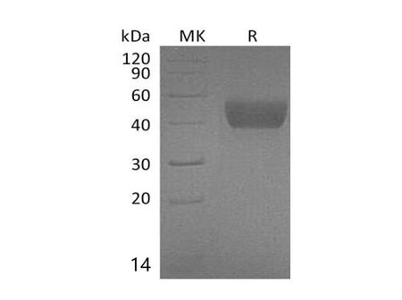 Recombinant Mouse FSTL1 Protein (His Tag) 