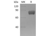 Recombinant Mouse FSTL1 Protein (Fc Tag)