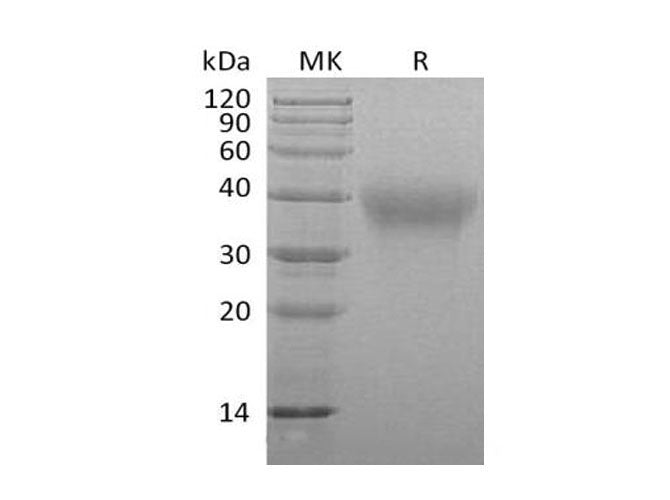 Recombinant Mouse Frizzled 1/FZD1 Protein (Fc Tag)