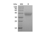 Recombinant Mouse Frizzled 1/FZD1 Protein (Fc Tag)