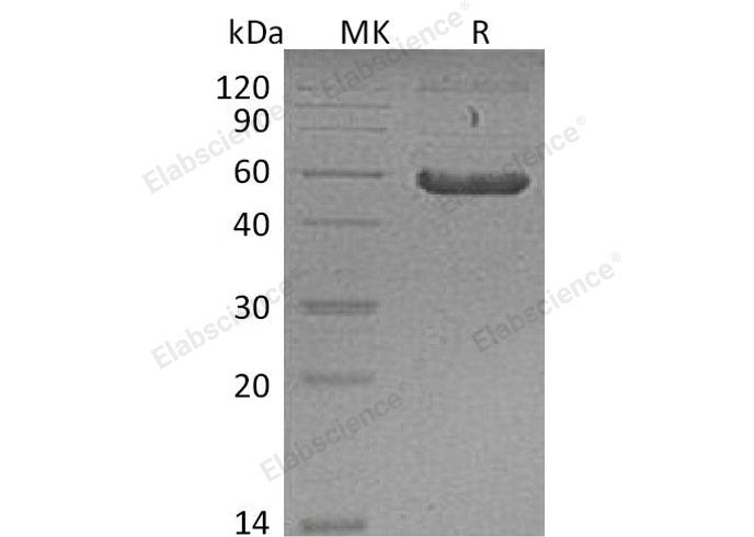 Recombinant Mouse Frizzled 2/FZD2 Protein (Fc Tag)