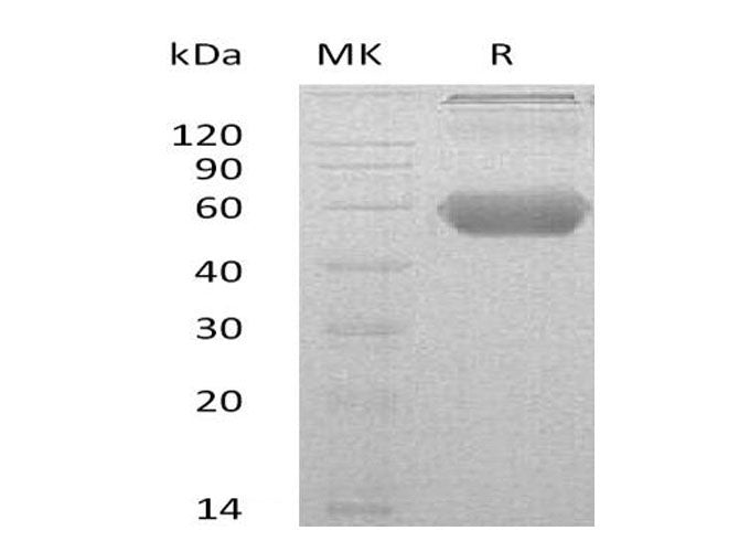 Recombinant Mouse GITR/TNFRSF18 Protein (Fc & His Tag)(Active)