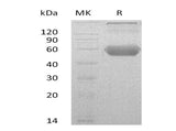 Recombinant Mouse GITR/TNFRSF18 Protein (Fc & His Tag)(Active)