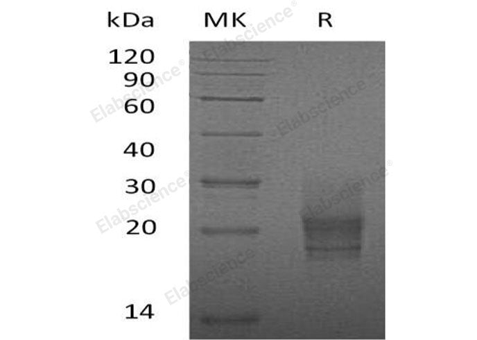 Recombinant Mouse GM-CSF/CSF2 Protein (His Tag)(Active)