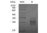Recombinant Mouse GM-CSF/CSF2 Protein (His Tag)(Active)