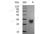 Recombinant Mouse G-CSF/CSF3 Protein (His Tag)