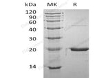 Recombinant Mouse GH1/Growth Hormone Protein