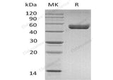Recombinant Mouse CD74 Protein (mFc & His Tag)