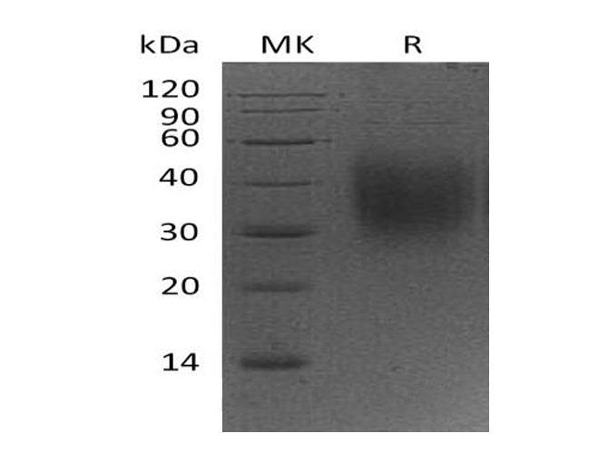 Recombinant Mouse CD47 Protein (His Tag) (Active)