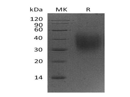 Recombinant Mouse CD47 Protein (His Tag) (Active)