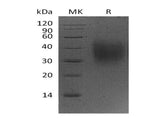 Recombinant Mouse CD47 Protein (His Tag) (Active)
