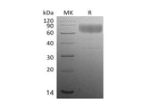 Recombinant Mouse CD47 Protein (Fc Tag)
