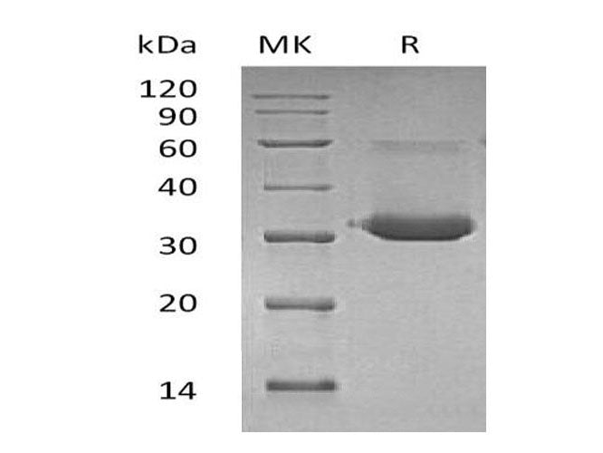 Recombinant Mouse IgG1 Fc/IGHG1 Protein
