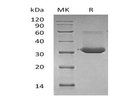 Recombinant Mouse IgG1 Fc/IGHG1 Protein
