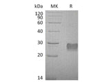 Recombinant Mouse IGFBP6/IGFBP-6 Protein (His Tag)