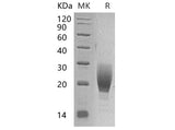 Recombinant Mouse IL1R1/CD121a Protein (Fc Tag)