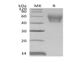 Recombinant Mouse IL1R2/CD121b Protein (His Tag)