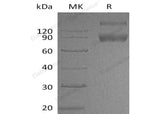 Recombinant Mouse IL1R2/CD121b Protein (Fc Tag)