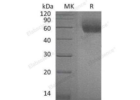 Recombinant Mouse IL1RL1/ST2 Protein (His Tag)