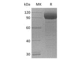 Recombinant Mouse IL1RL1/ST2 Protein (Fc Tag) (Active)