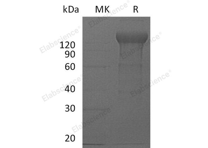 Recombinant Mouse IL12RB2/IL12R-beta 2 Protein (Fc Tag)