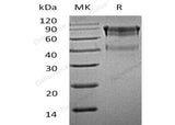 Recombinant Mouse IL15RA/CD215 Protein (Fc Tag)(Active)