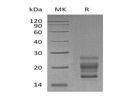 Recombinant Mouse IL-17A Protein (His Tag)(Active)