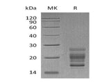 Recombinant Mouse IL-17A Protein (His Tag)(Active)