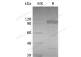 Recombinant Mouse IL-23 Receptor/IL-23R Protein (Fc Tag) 